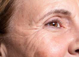 Picture of Facial Waxing